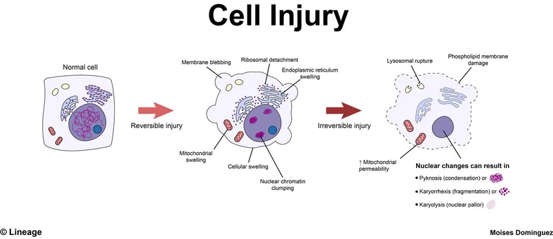 Cellular injury cascade showing progression from normal cell to necrosis