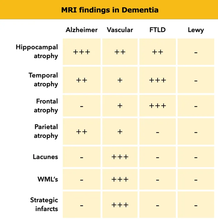 Comparative brain imaging showing different patterns of atrophy in dementia types