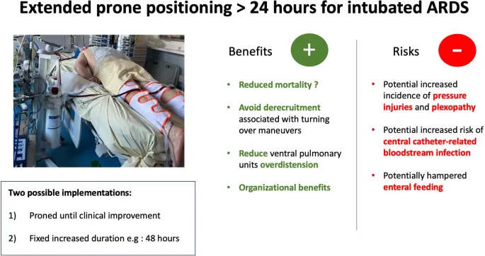 Patient in prone position with mechanical ventilation for ARDS management