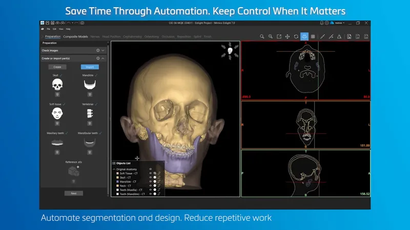 3D surgical planning software showing bone reconstruction
