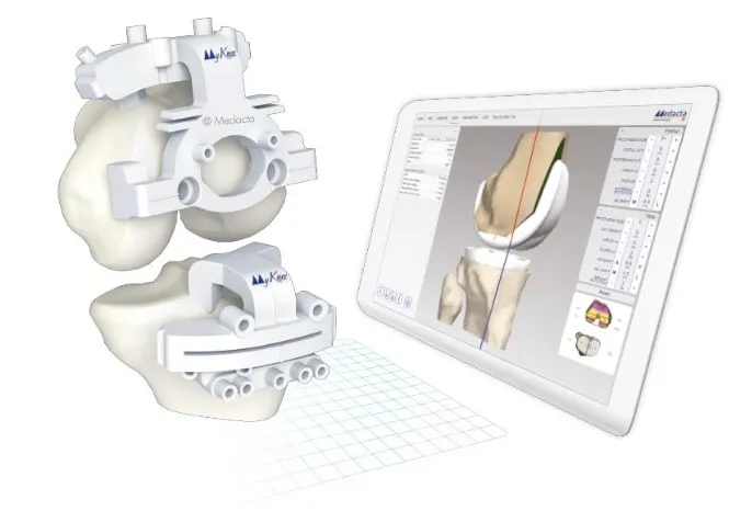 Patient-specific instrumentation guides for knee replacement