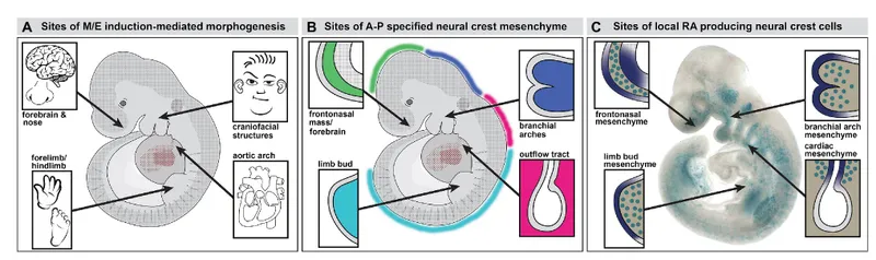 Neural crest cell migration pathways and associated defect patterns