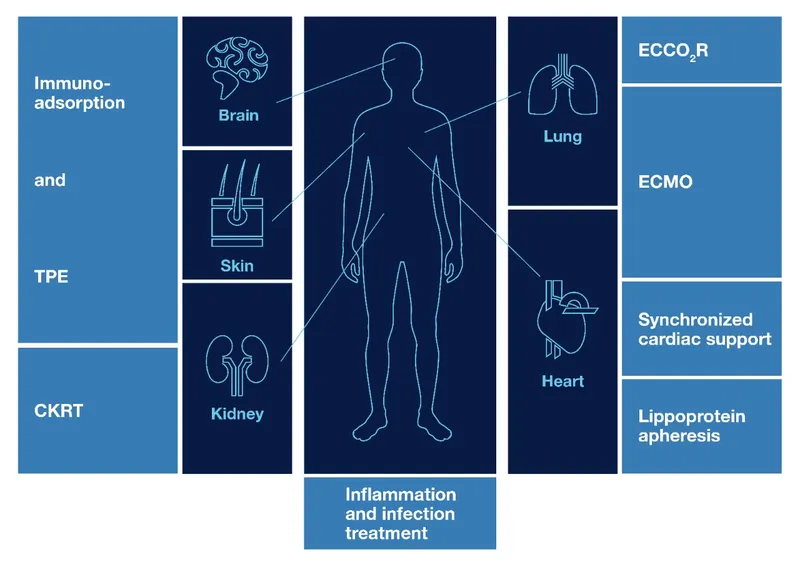 ICU monitoring setup with multiple organ support systems