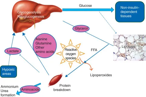 Metabolic stress response critical illness catabolism anabolism
