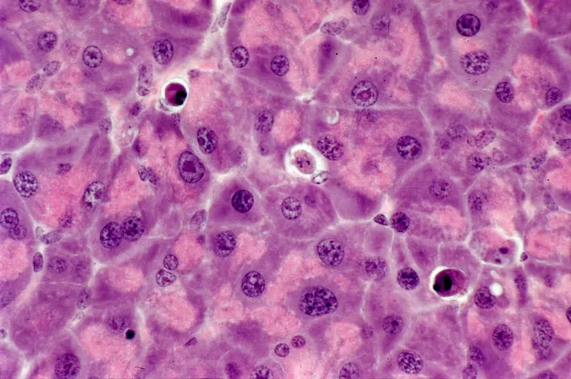 Detailed cellular morphology showing nuclear and cytoplasmic features