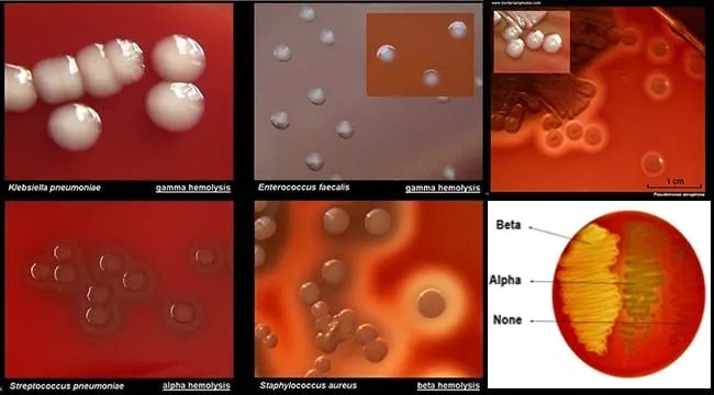 Bacterial colonies showing different morphologies on blood agar plate
