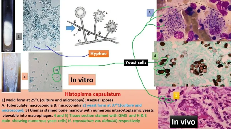 Laboratory workflow diagram for dimorphic fungi identification