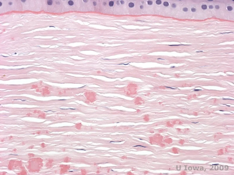 stromal collagen electron microscopy