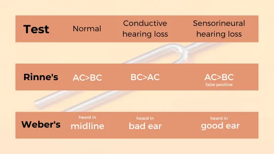 Comparison chart showing conductive versus sensorineural hearing loss patterns on audiometry