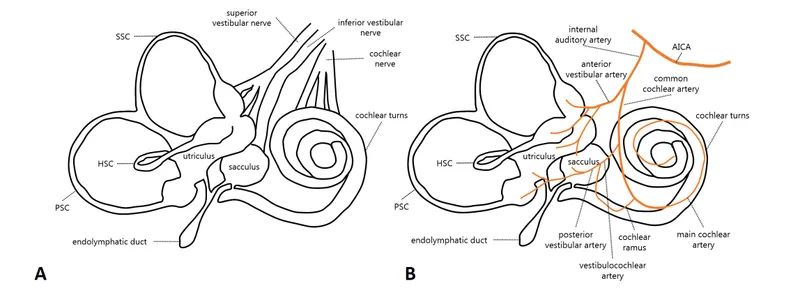 Vascular anatomy diagram showing blood supply to the inner ear and potential sites of pathology