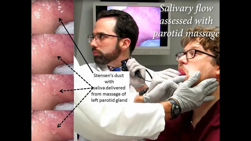 Demonstration of proper salivary gland massage technique