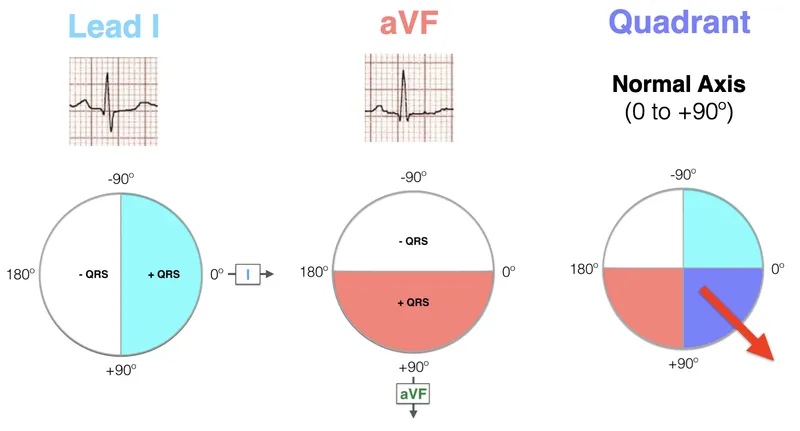 Cardiac axis diagram showing normal left and right axis deviation ranges