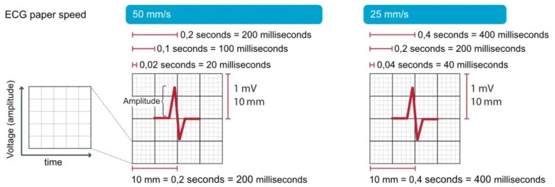 ECG paper with time and voltage calibrations showing measurement grid