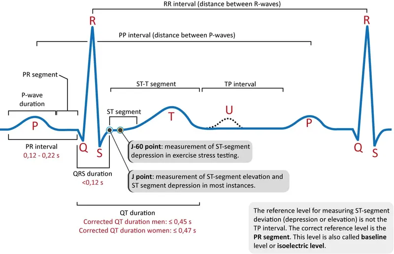 Detailed ECG waveform components showing P QRS T wave measurements