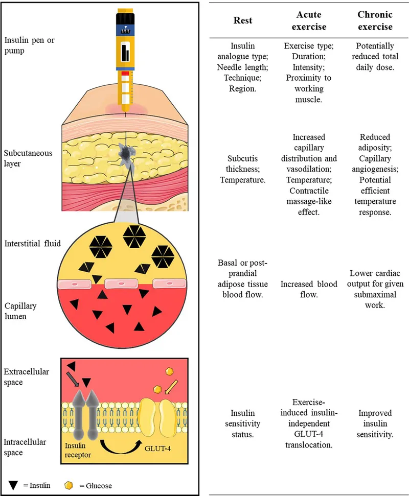 Diagram showing insulin injection sites and absorption rates for diabetes management