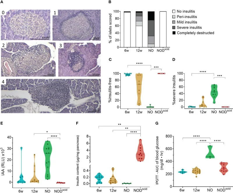 Microscopic image of pancreatic islet showing inflammatory infiltration in autoimmune diabetes
