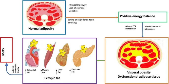 Anatomical diagram showing visceral fat distribution and inflammatory cytokine production