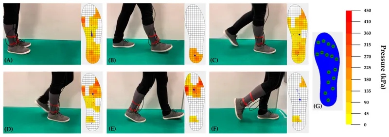 Gait cycle analysis showing foot pressure distribution patterns