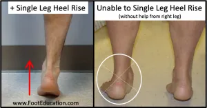Clinical examination techniques for medial ankle pain assessment