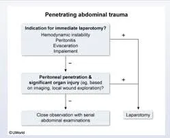 Acute abdomen differential algorithm