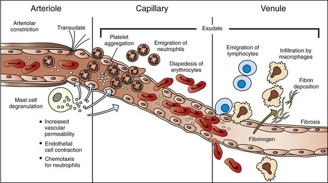 Inflammatory cascade pathway