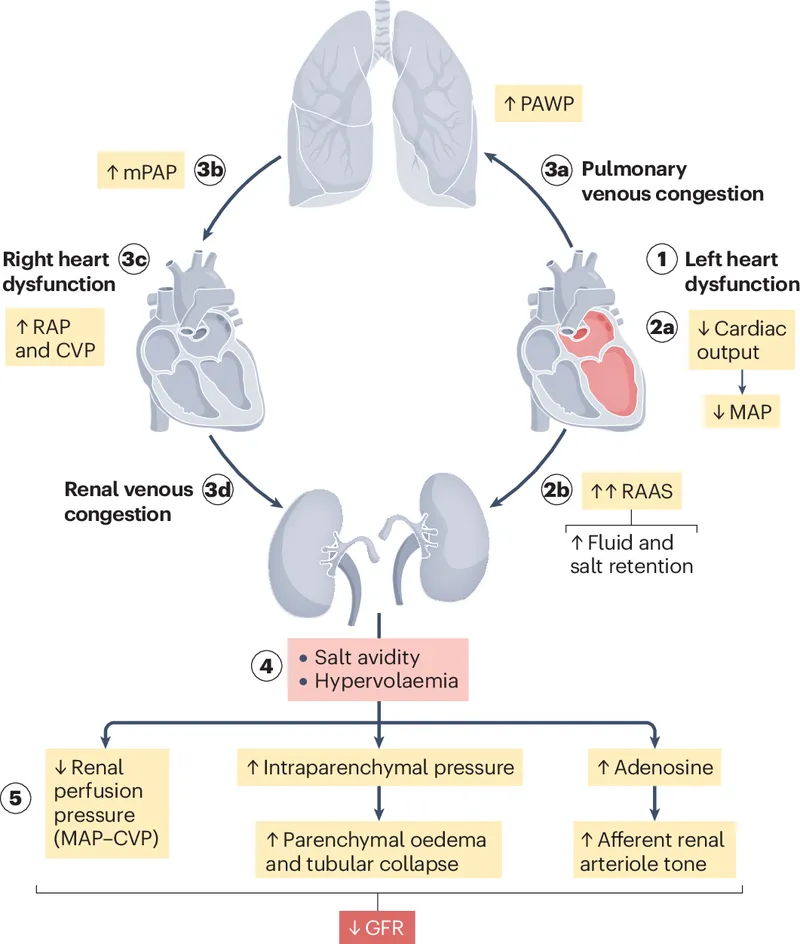 Diagram showing multi-organ effects of heart failure on different body systems