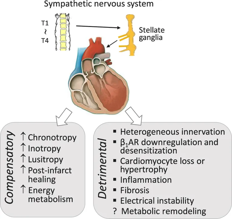 Diagram showing sympathetic nervous system activation in heart failure