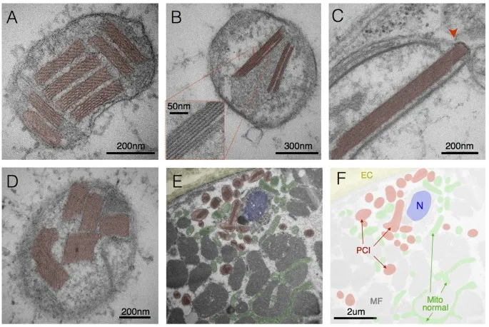 Electron microscopy showing normal vs injured cell ultrastructure