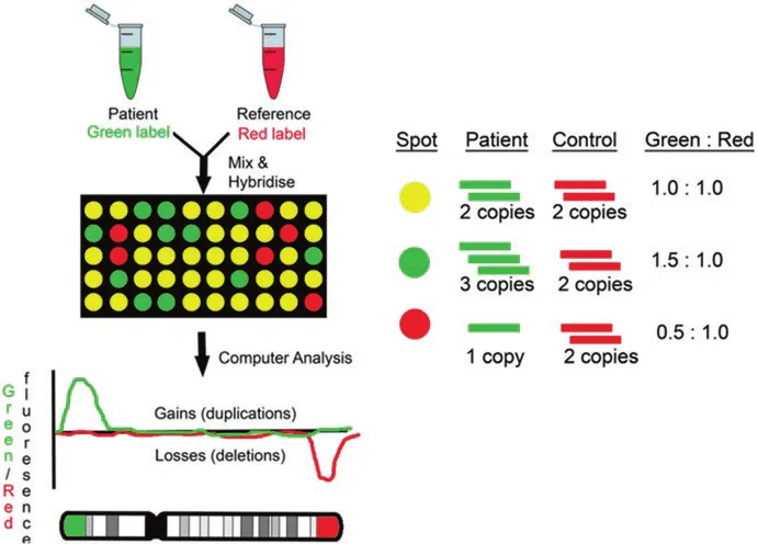 Chromosomal microarray analysis showing copy number variations