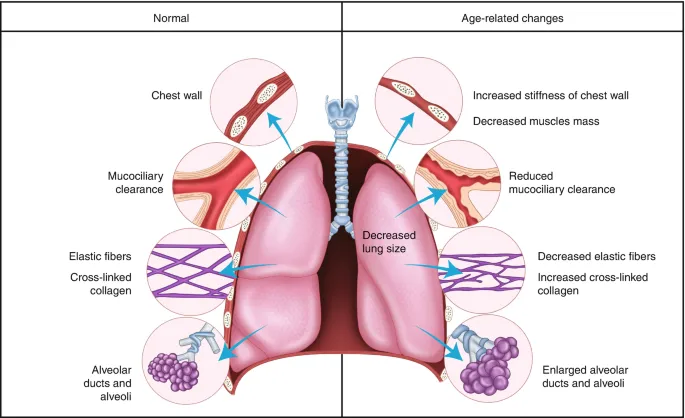 Respiratory aging changes showing alveolar destruction and chest wall stiffening