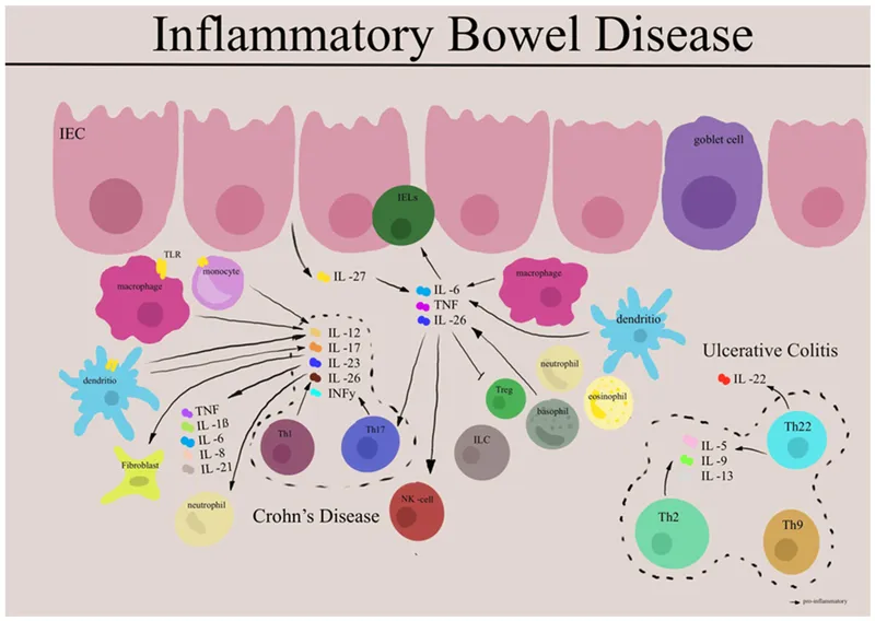 Inflammatory cascade diagram showing cytokine pathways in IBD