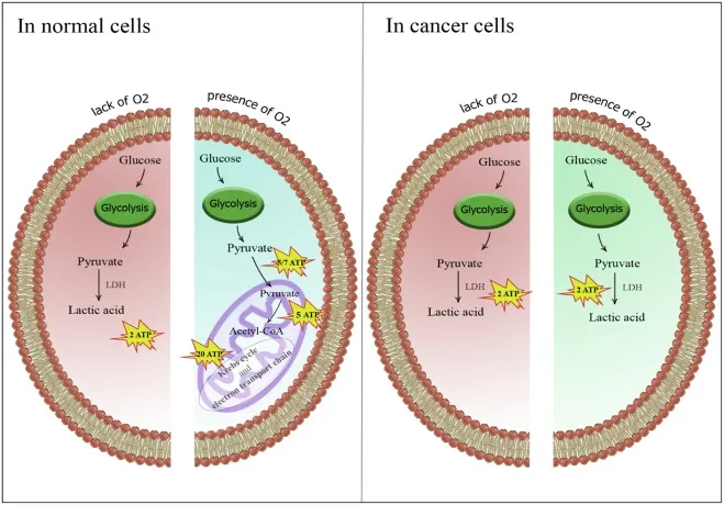 Cancer cell glycolytic reprogramming Warburg effect