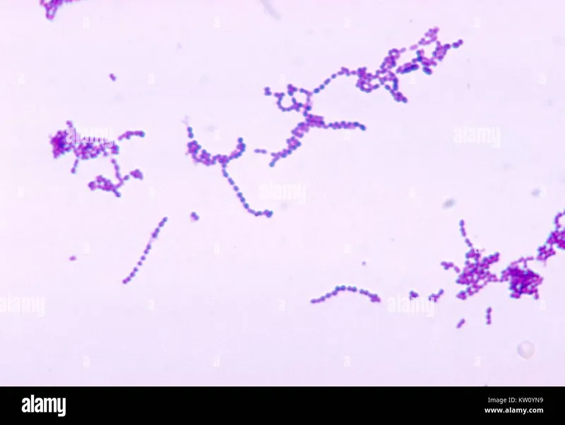 Laboratory gram stain showing gram-positive cocci in chains