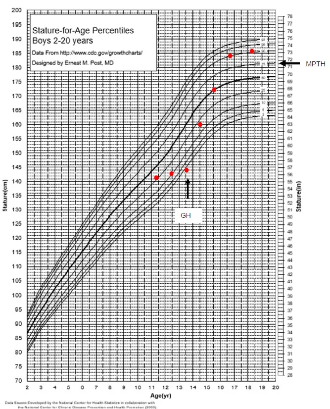 Graph showing growth hormone treatment response curves over 5 years of therapy