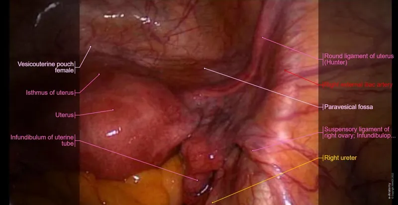 Laparoscopic view of normal pelvic anatomy with labeled structures