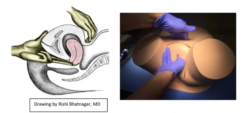 Diagram showing systematic pelvic examination technique and anatomical landmarks