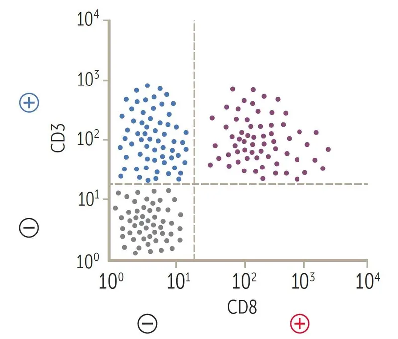 mixed phenotype acute leukemia