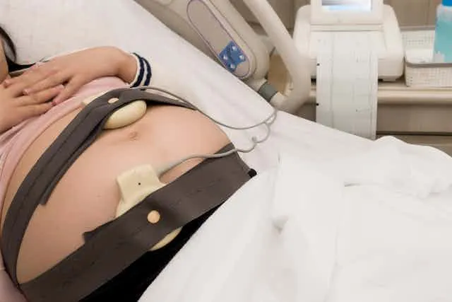 Fetal monitoring equipment showing continuous surveillance in high-risk pregnancy