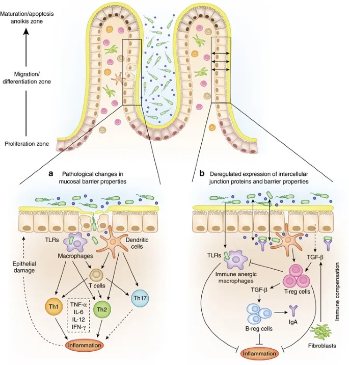 Microscopic view of intestinal barrier showing tight junctions and mucus layer in health versus IBD