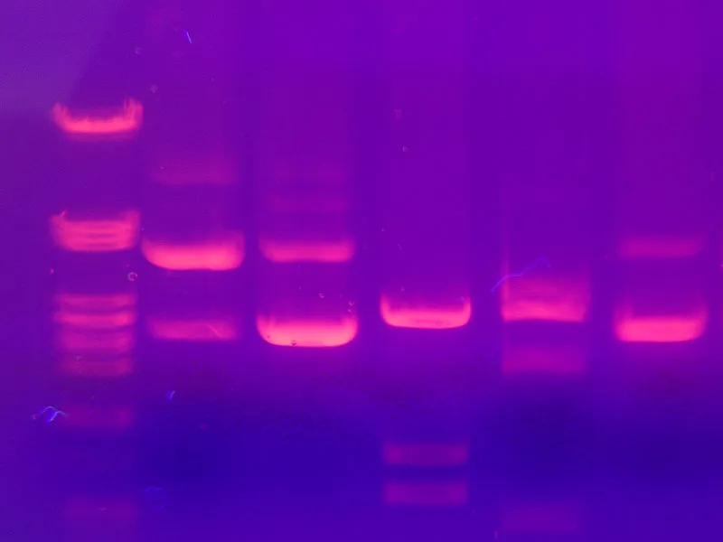 DNA profiling gel electrophoresis