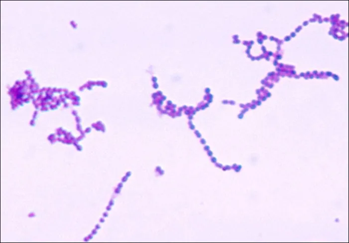 Microscopic view of various bacterial pathogens including Staphylococcus and Streptococcus