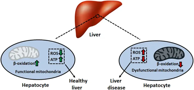 Hepatocyte injury cascade showing mitochondrial damage and oxidative stress
