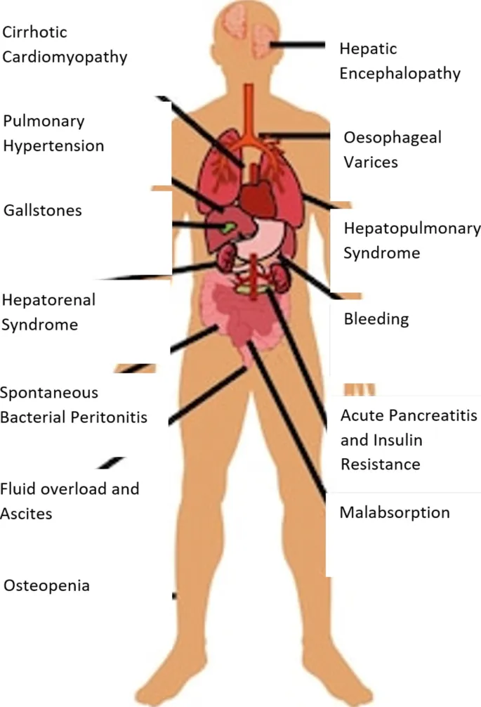 Multi-system effects of liver disease on cardiovascular and renal function
