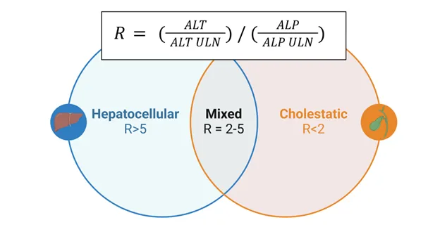 Laboratory patterns distinguishing hepatocellular from cholestatic liver injury