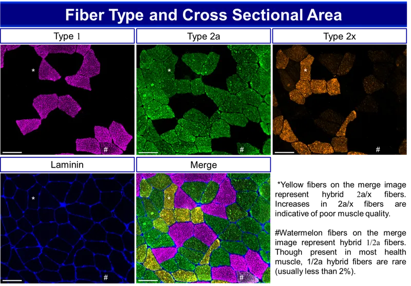 Histological comparison of muscle fiber types in lower limb muscles