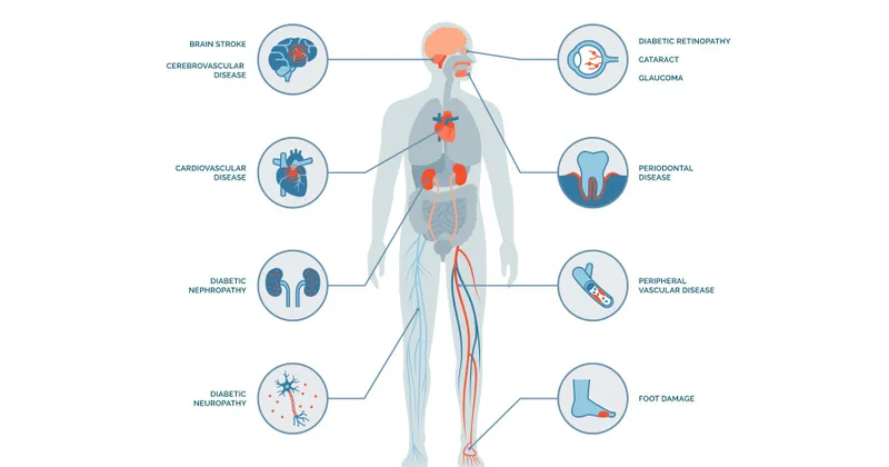Type 2 diabetes complications retinopathy nephropathy cardiovascular