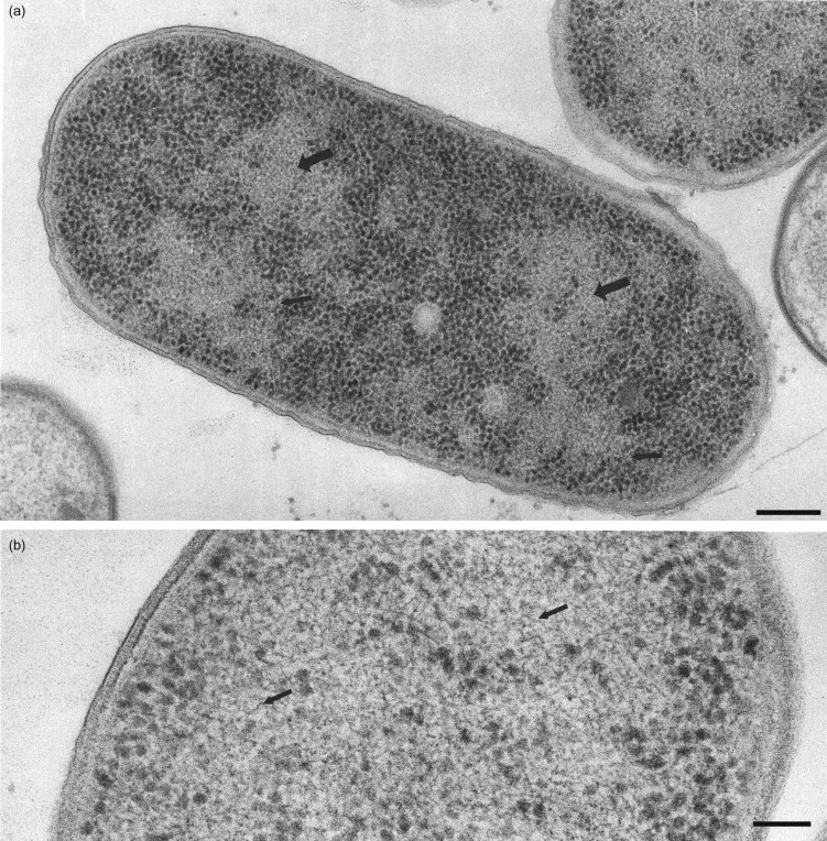 Bacterial chromosome structure showing nucleoid organization and supercoiling