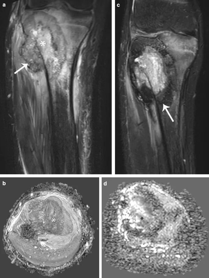 Chemotherapy response assessment and surgical timing
