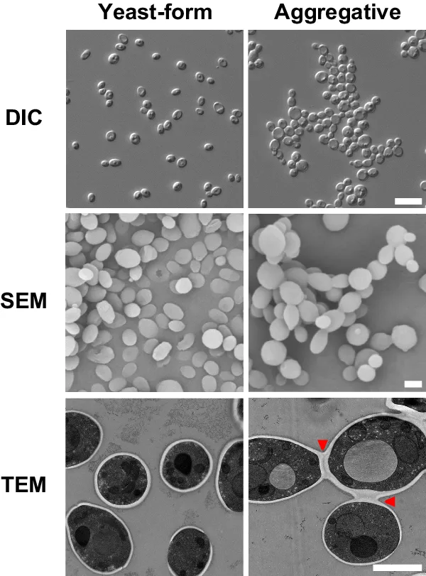 Microscopic image of Candida auris showing characteristic morphology