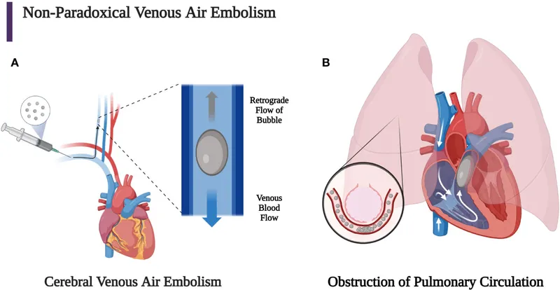 Diagram showing venous air embolism pathophysiology and treatment